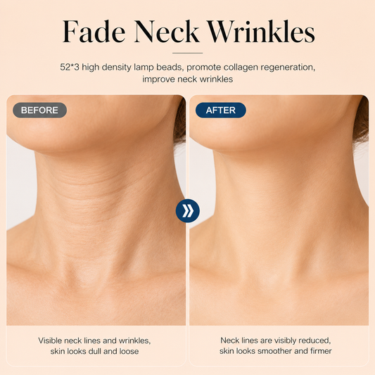 Solavele LED Neck Renewal